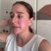 WEDDING SERIES | Getting My 1st CHEMICAL PEEL & Wedding Planning!