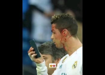 ????????renardo???? attacking head ???? very painful satuwation #trending #viral #short #viralshorts