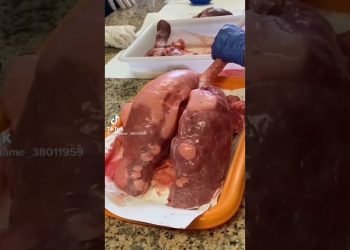 AIIMS Delhi????, Doctor Status❤️, Dream???? College, NEET aspirant Motivational???? Video MBBS DOCTOR, #short