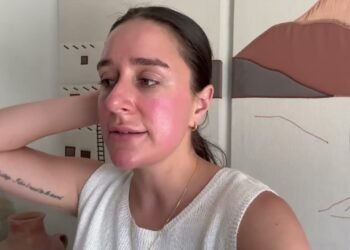 WEDDING SERIES | Getting My 1st CHEMICAL PEEL & Wedding Planning!